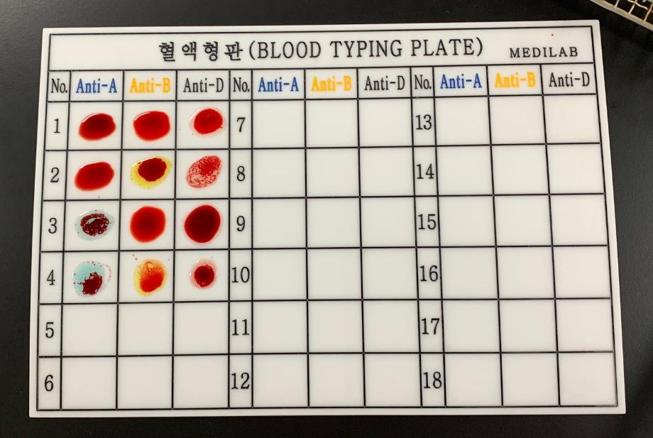 ABO TYPING을 진행